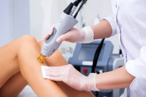 Up to 81% Off on Six Laser Hair Removal Sessions